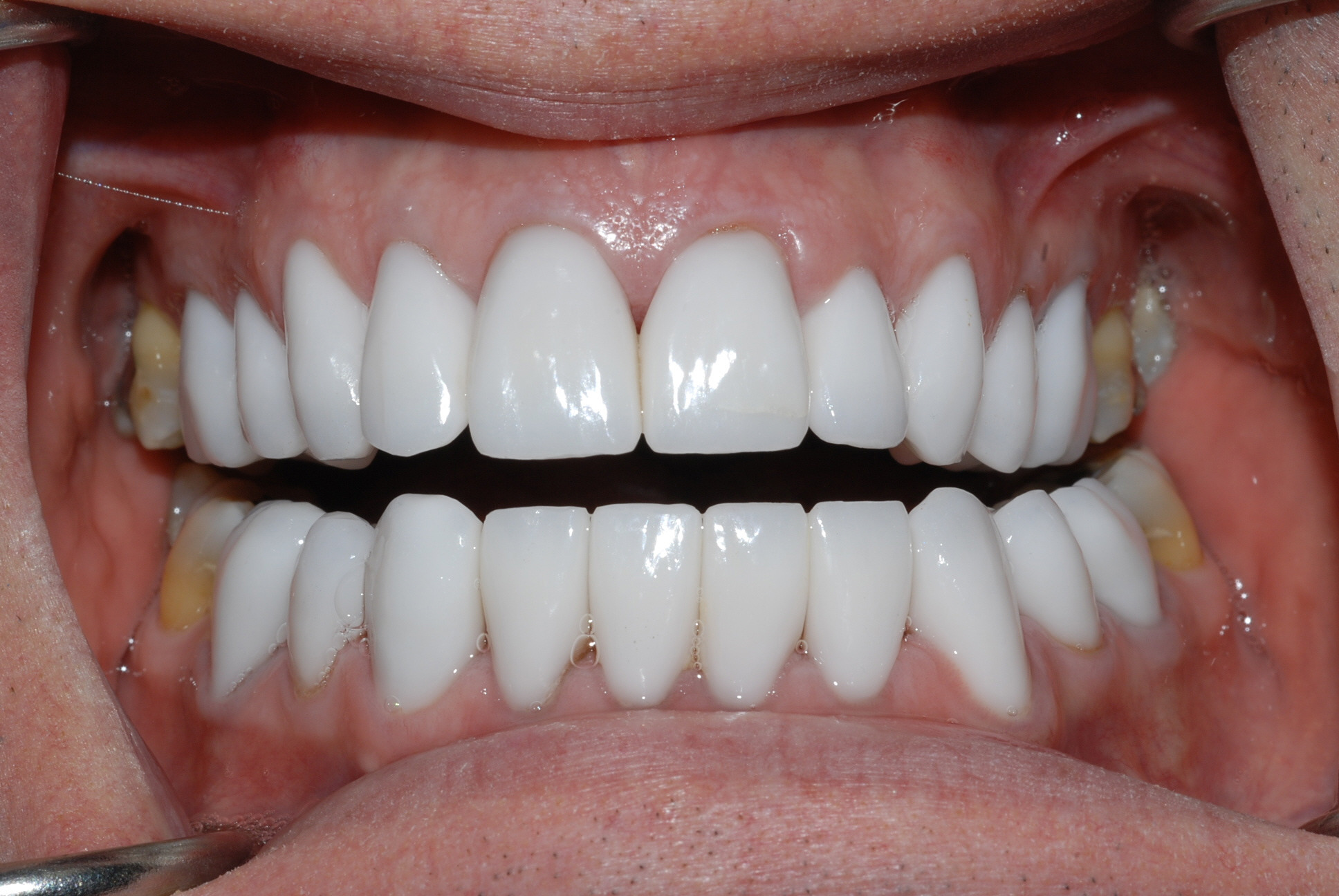 Atlanta Cosmetic Dentistry Dr. Mastro, Alluring Cosmetic Dentistry